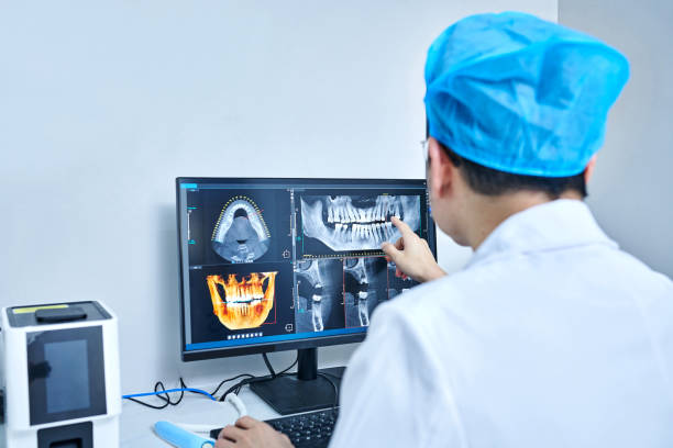 Best Emergency Wisdom Teeth Removal in Spinnerstown, PA